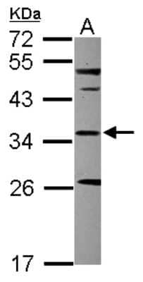 Western Blot: Sterol carrier protein 2 Antibody [NBP2-20511] - Sample (30 ug of whole cell lysate) A: HCT116 12% SDS PAGE gel, diluted at 1:1000.