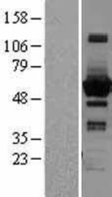 Western Blot: Sterol carrier protein 2 Overexpression Lysate (Adult Normal) [NBL1-15749] Left-Empty vector transfected control cell lysate (HEK293 cell lysate); Right -Over-expression Lysate for Sterol carrier protein 2.