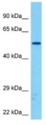 Western Blot: Stk-ps2 Antibody [NBP3-10259] - Western blot analysis of Stk-ps2 in Mouse Skeletal Muscle lysates. Antibody dilution at 1ug/ml