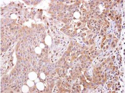 Immunohistochemistry-Paraffin: Stomatin-like protein 1 Antibody [NBP1-32227] - Paraffin-embedded HSC-3 xenograft. STOML1 antibody [N2C3] dilution: 1:250.