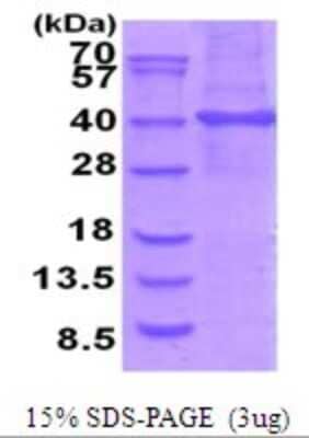 SDS-PAGE Recombinant Human Stomatin-like protein 1 His Protein