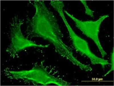 Immunocytochemistry/Immunofluorescence: Stonin-1 Antibody (1F3) [H00011037-M01] - Analysis of monoclonal antibody to STON1 on HeLa cell . Antibody concentration 10 ug/ml.