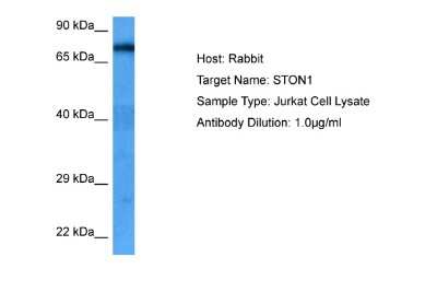 Western Blot: Stonin-1 Antibody [NBP2-88373] - Host: Rabbit. Target Name: STON1. Sample Tissue: Human Jurkat Whole Cell lysates. Antibody Dilution: 1ug/ml