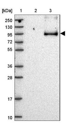 Western Blot: Storkhead Box 2 Antibody [NBP2-30480] - Lane 1: Marker  [kDa] 250, 130, 95, 72, 55, 36, 28, 17, 10.  Lane 2: Human cell line RT-4.  Lane 3: Human cell line U-251MG sp