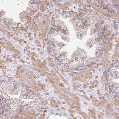Immunohistochemistry-Paraffin: Sulfatase 1 Antibody [NBP2-31584] - Staining of human prostate shows moderate cytoplasmic positivity in smooth muscle cells.