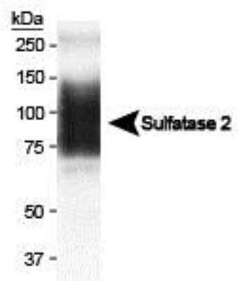 Western Blot: Sulfatase-2/SULF2 Antibody (2B4) - Azide and BSA Free [NBP2-80967] - Analysis showing Sulfatase 2 expression in MCF7 conditioned media (CM). In CM, the 75 kDa band is dominant (Tang R, Rosen SD. J Biol Chem. 2009 Aug 7;284(32):21505-14). Image courtesy of Mark Singer at UCSF. Image from the standard format of this antibody.