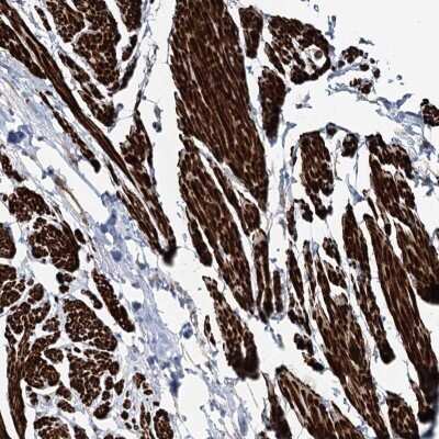 Immunohistochemistry-Paraffin: Sulfatase Modifying Factor 1/SUMF1 Antibody [NBP1-83905] - Staining of human smooth muscle shows strong cytoplasmic positivity in smooth muscle cells.