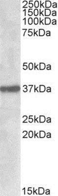 Western Blot: Sulfatase Modifying Factor 1/SUMF1 Antibody [NBP1-45212] -  Analysis of SUMF1 in Mouse Pancreas lysate (35ug protein in RIPA buffer) using NBP1-45212 at 1ug/ml. Primary incubation was 1 hour. Detected by chemiluminescence.