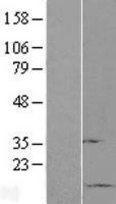 Western Blot: Sumo 1 Overexpression Lysate (Adult Normal) [NBL1-16612] Left-Empty vector transfected control cell lysate (HEK293 cell lysate); Right -Over-expression Lysate for Sumo 1.