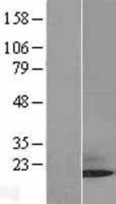 Western Blot: Sumo 3 Overexpression Lysate (Adult Normal) [NBL1-16613] Left-Empty vector transfected control cell lysate (HEK293 cell lysate); Right -Over-expression Lysate for Sumo 3.