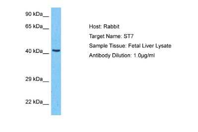 Western Blot: Suppression of Tumorigenicity 7 Antibody [NBP2-88380] - Host: Rabbit. Target Name: ST7. Sample Type: Fetal Liver lysates. Antibody Dilution: 1.0ug/ml