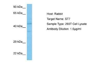 Western Blot Suppression of Tumorigenicity 7 Antibody - BSA Free
