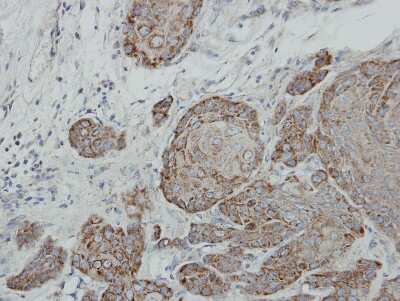 Immunohistochemistry-Paraffin: Suppressor of Fused Antibody [NBP2-20536] - Cal27 xenograft, using Suppressor of Fused antibody at 1:100 dilution. Antigen Retrieval: Trilogy™ (EDTA based, pH 8.0) buffer, 15min.