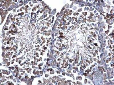 Immunohistochemistry-Paraffin: Suppressor of Fused Antibody [NBP2-20536] - Mouse testis. Suppressor of Fused antibody [C1C4] dilution: 1:500. Antigen Retrieval: Trilogy™ (EDTA based, pH 8.0) buffer, 15min.
