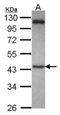 Western Blot: Suppressor of Fused Antibody [NBP2-20536] - Sample (30 ug of whole cell lysate) A: Hela 10% SDS PAGE gel, diluted at 1:1000.