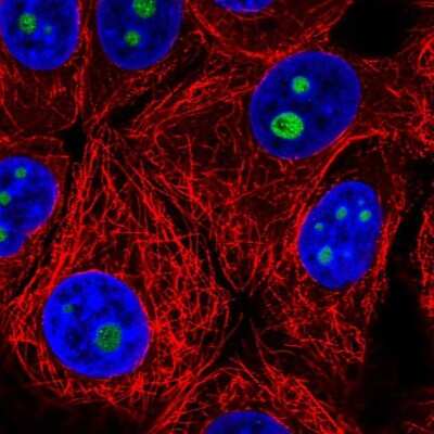 Immunocytochemistry/Immunofluorescence: Surf6 Antibody [NBP2-57677] - Staining of human cell line MCF7 shows localization to nucleoli.