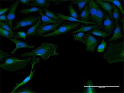 Immunocytochemistry/Immunofluorescence: Surfactant Protein A Antibody (4D6) [H00653509-M07] - Immunofluorescence of purified MaxPab antibody to LOC541473 on HeLa cell. [antibody concentration 10 ug/ml]