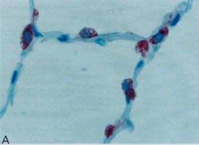 Immunohistochemistry-Paraffin: Surfactant Protein A Antibody (6F10) [NBP2-41344] - Analysis using the Biotin conjugate of NBP2-41344. Staining of sections of human lung