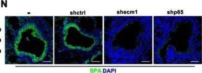 <b>Biological Strategies Validation. </b>Immunocytochemistry/Immunofluorescence: Surfactant Protein A Antibody [NBP2-12928] - GPRC5A deficiency promotes NF-kB-mediated ECM1 expression elevation in Lgr5 cells and secreted ECM1-induced AT2 cell enrichment in the S/TB region. IF analysis of AT2 SPA (Surfactant Protein A) cells in the lung S/TB region after KO:Lgr5 cells with ECM1 or p65 knockdown and injected into NOD/SCID mice through tail vein, (Bar = 100 um); Data were collected from three independent experiments with triplicate samples. **P < 0.01; ***P < 0.001. Image collected and cropped by CiteAb from the following publication (www.nature.com/articles/s41388-020-1251-2) licensed under a CC-BY license.