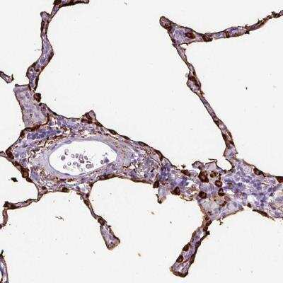 Immunohistochemistry-Paraffin: Surfactant Protein A Antibody [NBP2-46720] - Staining of human lung shows strong cytoplasmic and membranous positivity in pneumocytes.