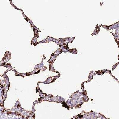 Immunohistochemistry-Paraffin: Surfactant Protein A Antibody [NBP2-46771] - Staining of human lung shows strong cytoplasmic positivity in a fraction of pneumocytes.