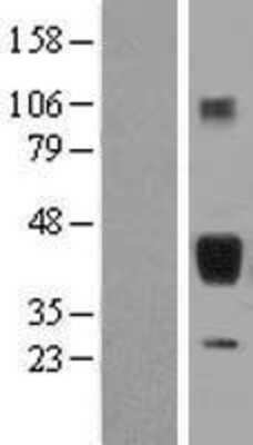 Western Blot: Surfactant Protein B Overexpression Lysate (Adult Normal) [NBL1-15894] Left-Empty vector transfected control cell lysate (HEK293 cell lysate); Right -Over-expression Lysate for Surfactant Protein B.