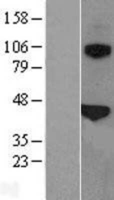 Western Blot: Surfactant Protein B Overexpression Lysate (Adult Normal) [NBL1-15895] Left-Empty vector transfected control cell lysate (HEK293 cell lysate); Right -Over-expression Lysate for Surfactant Protein B.