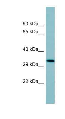 Western Blot: Surfactant protein D Antibody [NBP1-58977] - Human Thymus lysate, concentration 0.2-1 ug/ml.