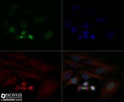 Immunocytochemistry/Immunofluorescence: Survivin Antibody (1277A) - Azide and BSA Free [NBP2-80971] - HeLa cells were fixed for 10 minutes using 10% formalin and then permeabilized for 5 minutes using 1X TBS + 0.5% Triton X-100. The cells were incubated with Survivin Antibody (1277A) [NBP2-59503] at 2 ug/ml overnight at 4C and detected with an anti-rabbit DyLight 488 (Green) at a 1:500 dilution. Alpha tubulin (DM1A) [NB100-690] was used as a co-stain at a 1:1000 dilution and detected with an anti-mouse DyLight 550 (Red) at a 1:500 dilution. Nuclei were counterstained with DAPI (Blue). Cells were imaged using a 40X objective. Image from the standard format of this antibody.