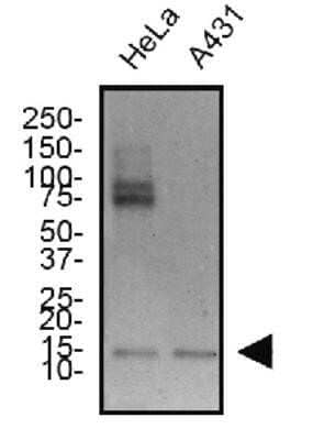 Western Blot: Survivin Antibody (1277A) - Azide and BSA Free [NBP2-80971] - Total protein from human HeLa and A431 cell lines was separated on a 4-20% gel by SDS-PAGE, transferred to 0.2 um Polyvinylidene fluoride (PVDF) membrane and blocked in 5% non-fat milk in TBST. The membrane was probed with 1.0 ug/ml [NBP2-59503] in block buffer and detected with an anti-rabbit HRP secondary antibody using chemiluminescence. Note: predicted molecular weight is 16 kDa. Image from the standard format of this antibody.