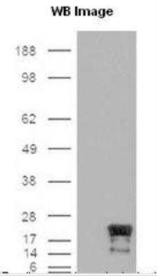 Western Blot: Survivin Antibody (60.11) - Unpurified [NB500-205] - Cells were transfected with the pCMV6-ENTRY control or pCMV6-ENTRY Survivin cDNA for 48 hrs and lysed. Equivalent amounts of cell lysates (5 ug per lane) were separated by SDS-PAGE and immunoblotted with  [NB500-205]. Note: theoretical molecular weight for Survivin is 16 kDa.