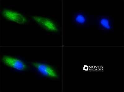 Immunocytochemistry/Immunofluorescence: Survivin Antibody (8E2) - Azide and BSA Free [NBP2-80970] - Immunocytochemical analysis using Survivin Antibody (8E2) [NB500-644] was tested in HeLa cells with FITC (green). Nuclei were counterstained with DAPI (blue). Image from the standard format of this antibody.