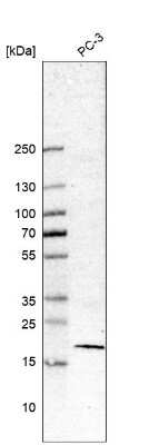 Western Blot: Survivin Antibody (CL12064) [NBP3-18538] - Analysis in human cell line PC-3.