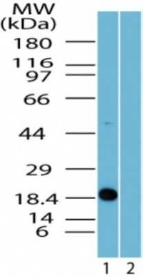 Western Blot: Survivin Antibody [NBP2-24395] - Analysis of Survivin in Jurkat cell lysate in the 1) absence, and 2) presence of immunizing peptide using  [NBP2-24395] at 2 ug/ml. Note: detection higher than the predicted molecular weight of 16 kDa.