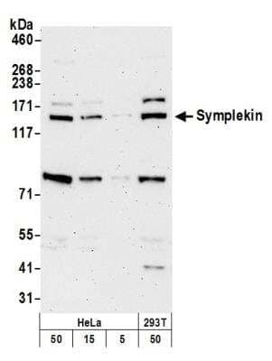 Western Blot: Symplekin Antibody [NB100-74591] - Detection of Human and Mouse Symplekin by Western Blot. Samples: Whole cell lysate from HeLa, (5, 15 and 50 ug), and 293T (50ug) cells prepared using NETN lysis buffer. Antibody: Affinity purified rabbit anti-Symplekin antibody NB100-74591 used for WB at 0.02 ug/ml. Detection: Chemiluminescence with an exposure time of 3 minutes.