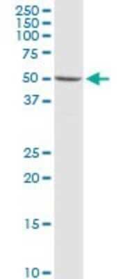 Western Blot: Synapsin 3 Antibody [H00008224-D01P] - Analysis of SYN3 expression in A-431.