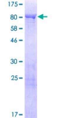 SDS-Page: Synapsin 3 Recombinant Protein [H00008224-P01]