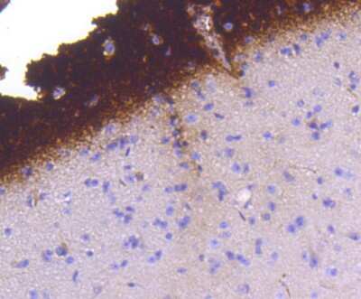 Immunohistochemistry-Paraffin: Synapsin I [p Ser9] Antibody (SN63-04) [NBP2-67662] - Analysis of paraffin-embedded mouse brain tissue using anti- phospho-Synapsin I (S9) antibody. Counter stained with hematoxylin.