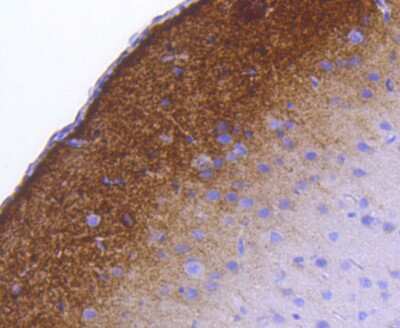 Immunohistochemistry-Paraffin: Synapsin I [p Ser9] Antibody (SN63-04) [NBP2-67662] - Analysis of paraffin-embedded rat brain tissue using anti- phospho-Synapsin I (S9) antibody. Counter stained with hematoxylin.