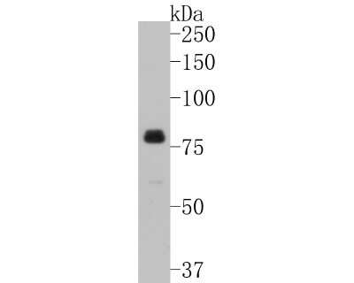 Western Blot: Synapsin I [p Ser9] Antibody (SN63-04) [NBP2-67662] - Immunohistochemical analysis of paraffin-embedded rat brain tissue using anti- phospho-Synapsin ? (S9) antibody. Counter stained with hematoxylin.