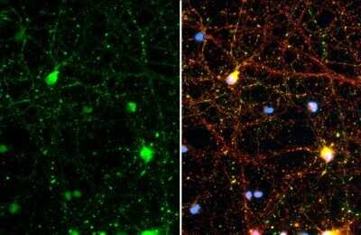 Immunocytochemistry/Immunofluorescence: Synapsin II Antibody (GT1446) [NBP3-13694] - Synapsin II antibody [GT1446] detects Synapsin II protein at synapse by immunofluorescent analysis. Sample: DIV10 rat E18 primary cortical neuron cells cells were fixed in 4% paraformaldehyde at RT for 15 min. Green: Synapsin II stained by Synapsin II antibody [GT1446] (NBP3-13694) diluted at 1:500. Red: Tau, a axon marker, stained by Tau antibody diluted at 1:500.