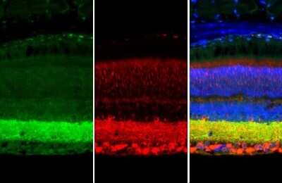 Immunohistochemistry-Paraffin: Synapsin II Antibody (GT1446) [NBP3-13694] - Synapsin II antibody [GT1446] detects Synapsin II protein at cell membrane and cytoplasm by immunohistochemical analysis. Sample: Paraffin-embedded mouse eye. Green: Synapsin II stained by Synapsin II antibody [GT1446] (NBP3-13694) diluted at 1:250. Red: beta Tubulin 3/ Tuj1, a cytoskeleton marker, stained by beta Tubulin 3/ Tuj1 antibody diluted at 1:500. Blue: Fluoroshield with DAPI. Antigen Retrieval: Citrate buffer, pH 6.0, 15 min