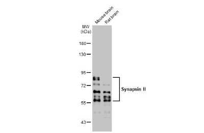 Western Blot: Synapsin II Antibody (GT1446) [NBP3-13694] - Various tissue extracts (50 ug) were separated by 7.5% SDS-PAGE, and the membrane was blotted with Synapsin II antibody [GT1446] (NBP3-13694) diluted at 1:10000. The HRP-conjugated anti-mouse IgG antibody (NBP2-19382) was used to detect the primary antibody.