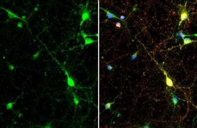 Immunocytochemistry/Immunofluorescence: Synapsin II Antibody (GT387) [NBP3-13689] - Synapsin II antibody [GT387] detects Synapsin II protein at synapse by immunofluorescent analysis. Sample: DIV10 rat E18 primary cortical neuron cells cells were fixed in 4% paraformaldehyde at RT for 15 min. Green: Synapsin II stained by Synapsin II antibody [GT387] (NBP3-13689) diluted at 1:500. Red: Tau, a axon marker, stained by Tau antibody diluted at 1:500.