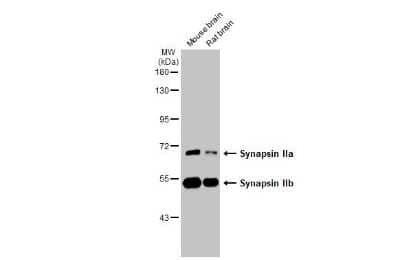 Western Blot: Synapsin II Antibody (GT387) [NBP3-13689] - Various tissue extracts (50 ug) were separated by 7.5% SDS-PAGE, and the membrane was blotted with Synapsin II antibody [GT387] (NBP3-13689) diluted at 1:1000. The HRP-conjugated anti-mouse IgG antibody (NBP2-19382) was used to detect the primary antibody.