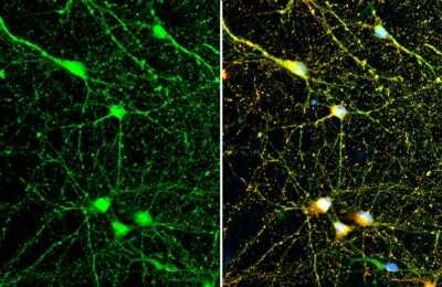 Immunocytochemistry/Immunofluorescence: Synapsin II Antibody (GT763) [NBP3-13695] - Synapsin II antibody [GT763] detects Synapsin II protein at synapse by immunofluorescent analysis. Sample: DIV10 rat E18 primary cortical neuron cells cells were fixed in 4% paraformaldehyde at RT for 15 min. Green: Synapsin II stained by Synapsin II antibody [GT763] (NBP3-13695) diluted at 1:500. Red: Tau, a axon marker, stained by Tau antibody diluted at 1:500.