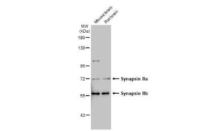 Western Blot: Synapsin II Antibody (GT763) [NBP3-13695] - Various tissue extracts (50 ug) were separated by 7.5% SDS-PAGE, and the membrane was blotted with Synapsin II antibody [GT763] (NBP3-13695) diluted at 1:1000. The HRP-conjugated anti-mouse IgG antibody (NBP2-19382) was used to detect the primary antibody.