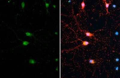 Immunocytochemistry/Immunofluorescence: Synapsin II Antibody (GT965) [NBP3-13690] - Synapsin II antibody [GT965] detects Synapsin II protein at synapse by immunofluorescent analysis. Sample: DIV10 rat E18 primary cortical neuron cells cells were fixed in 4% paraformaldehyde at RT for 15 min. Green: Synapsin II stained by Synapsin II antibody [GT965] (NBP3-13690) diluted at 1:500. Red: Tau, a axon marker, stained by Tau antibody diluted at 1:500.