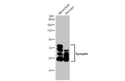 Western Blot: Synapsin II Antibody (GT965) [NBP3-13690] - Various tissue extracts (50 ug) were separated by 7.5% SDS-PAGE, and the membrane was blotted with Synapsin II antibody [GT965] (NBP3-13690) diluted at 1:1000. The HRP-conjugated anti-mouse IgG antibody (NBP2-19382) was used to detect the primary antibody.