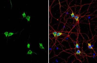 Immunocytochemistry/Immunofluorescence: Synapsin II Antibody [NBP3-13443] - Synapsin II antibody detects Synapsin II protein by immunofluorescent analysis. Sample: DIV10 rat E18 primary cortical neuron cells were fixed in 4% paraformaldehyde at RT for 15 min. Green: Synapsin II stained by Synapsin II antibody (NBP3-13443) diluted at 1:500. Red: Tau, stained by Tau antibody [GT287] diluted at 1:500. Blue: Fluoroshield with DAPI.